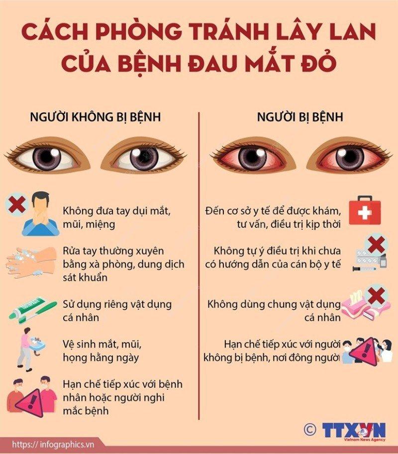 Bài tuyên truyền về bệnh "Đau mắt đỏ"